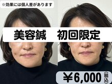 サロンスマイル