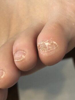 トゥーネイル(02nail)/