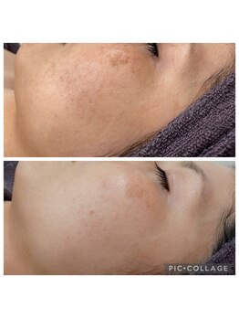 ビラ ベルダ(Bira Beldad)/