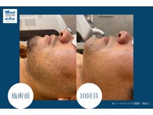 パラディソ+/お顔の印象UP！