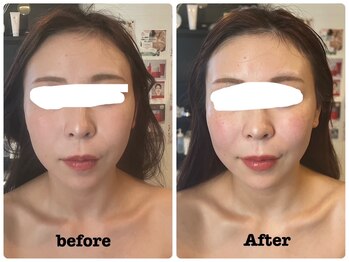 ジェミニ フェイス デザイン(Gemini Face Design)/