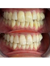 ライトビューティー 池袋店(LightBeauty)/症例写真