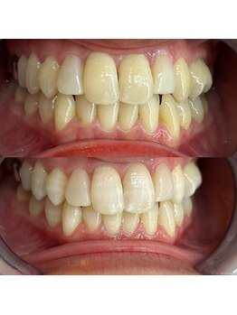 ライトビューティー 池袋店(LightBeauty)/症例写真