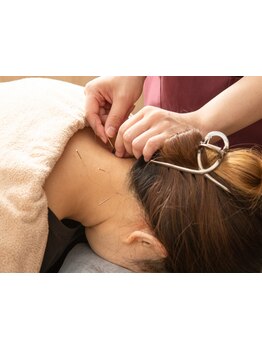 鍼灸施術を受けたい