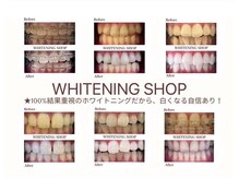 ホワイトニングショップ 池田店/【独自のジェルで理想の白さに】