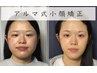 むくみ・サイズ感縮小◆《アルマ式小顔矯正》集中矯正コース 初回体験 60分