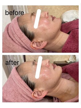 グッディ 北条店(Goody)/ウルトラフェイシャル90分