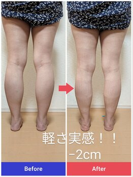 リバース(Re:Birth)/ドライヘッドスパと浮腫ケア