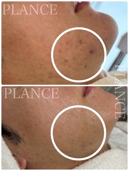 プランス 恵比寿店(PLANCE)/色味のお悩みもお任せください！