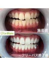 ルブラン 奈良店(Le Blanc)/身だしなみの一つ！！