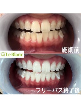 ルブラン 奈良店(Le Blanc)/身だしなみの一つ！！