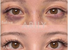 アリリィ(ARILY)/ARILY after care salon