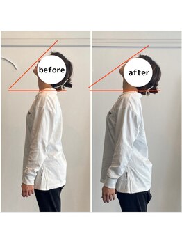 糸満メディカル整体/首の痛みも動きも改善