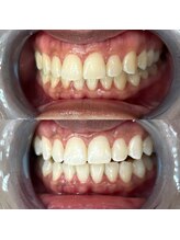 ライトビューティー 池袋店(LightBeauty)/症例写真