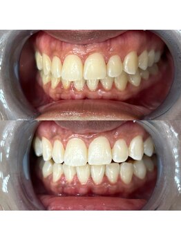 ライトビューティー 池袋店(LightBeauty)/症例写真