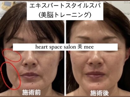 ミー(美mee)の写真