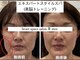 ミー(美mee)の写真