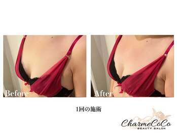 シャルムココ 蔵前店(CharmeCoCo)/お客様Before→After