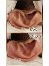 スマイリー(smiley)/