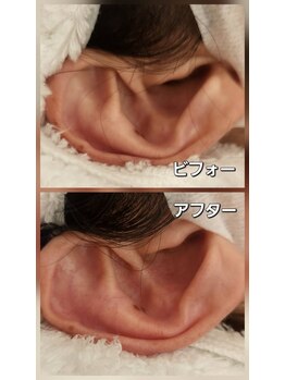 スマイリー(smiley)/