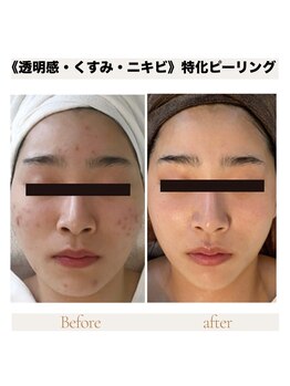 カナウ produced by きょうわ整体院(Kanau.)/《透明感・くすみ・ニキビ》