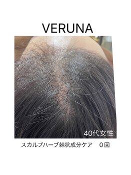 ココ 2号店(CoCo)/育毛促進/スカルプケア/頭皮改善