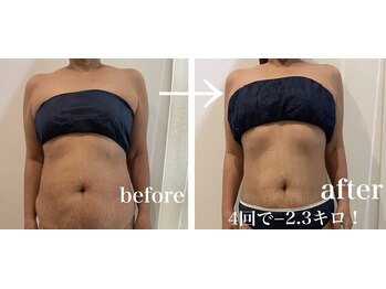 ドリームローズ(Dream Rose)/痩身