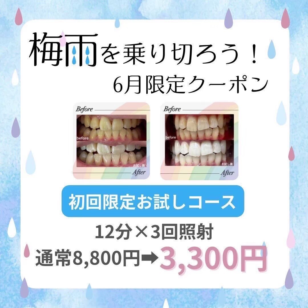 6月限定【とりあえず試したい】ホワイトニング12分×3回照射￥8,800→￥3,300