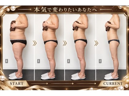 レン(ReN)の写真