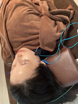 ハリファ鍼灸院 横浜関内院(HariFa鍼灸院)/美容施術