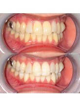 ライトビューティー 池袋店(LightBeauty)/症例写真