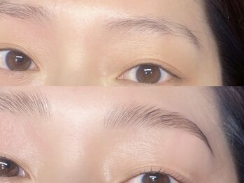 エデン(Eden)/HBL Before/After