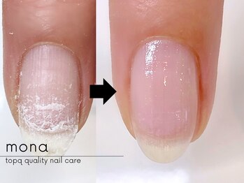 モナ(mona)/PCN care☆