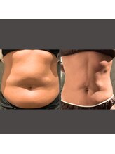 ノーブルノアール(Noble noir)/体は変えられる！！