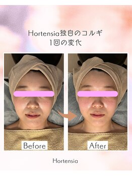 オルテンシア(Hortensia)/コルギ☆ビフォーアフター