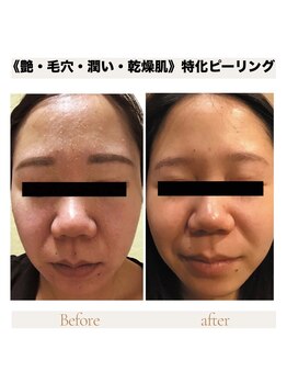 カナウ produced by きょうわ整体院(Kanau.)/水光ツヤ肌仕上がり