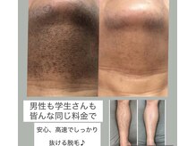 マスカレード 品川(Masquerade)の雰囲気（【スピーディで超抜ける！】脱毛30分当て放題¥8800が断然お得♪）