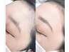 おでこWAX脱毛【眉上からおでこ迄の広範囲WAX】ツヤ肌おでこで魅力UP♪