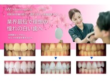 ホワイトニングショップ 三田店