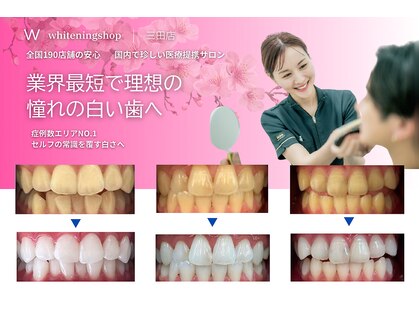 ホワイトニングショップ 三田店の写真