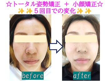 奏流(soryu)/魅せる美顔へ♪魅惑の小顔矯正★