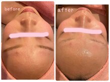 ヒメミ(Himemi)/艶肌Ｗａｘ