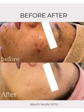 トット 恵比寿(totto)/ケア症例