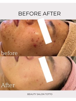 トット 恵比寿(totto)/ケア症例