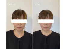 メイクアップス(makeups)/リフトアップフェイシャル