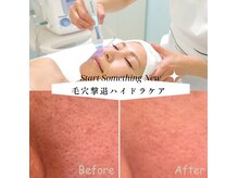 プラウド(Proud)の雰囲気（肌質改善/毛穴悩み/肌荒れ/ニキビケア/エイジングケア）