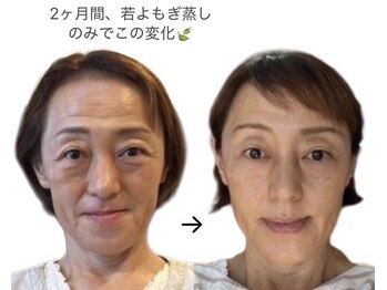 シュシュ(shushu)