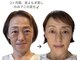 シュシュ(shushu)の写真
