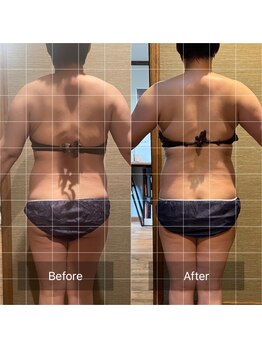 ドットカノア(.Kanoa)/お客様のbefore/after