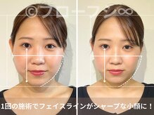 フローフシ∞